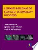Libro Lesiones benignas de esofágo, estómago y duodeno